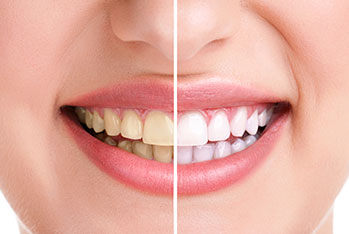 Corinthia Dental Clinic | Leduc Dentist | Cosmetic Dentistry